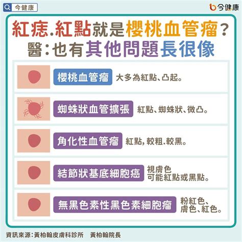 胸部紅色痣|皮膚長紅痣？「櫻桃血管瘤」上身小心肝異常、7成以。